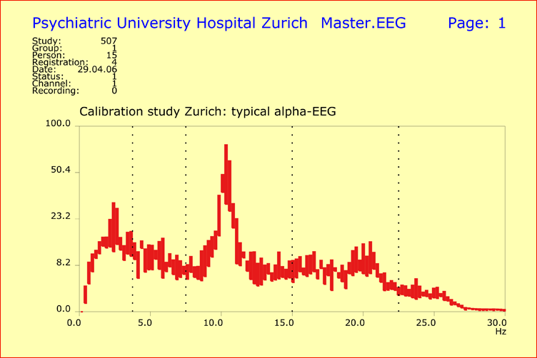 EEG spectral pattern