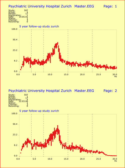 Longterm Stability of EEG Spectral Patterns