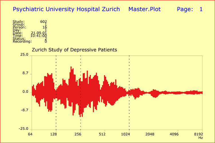 Characteristic variability of spectral intensities among depressive patients