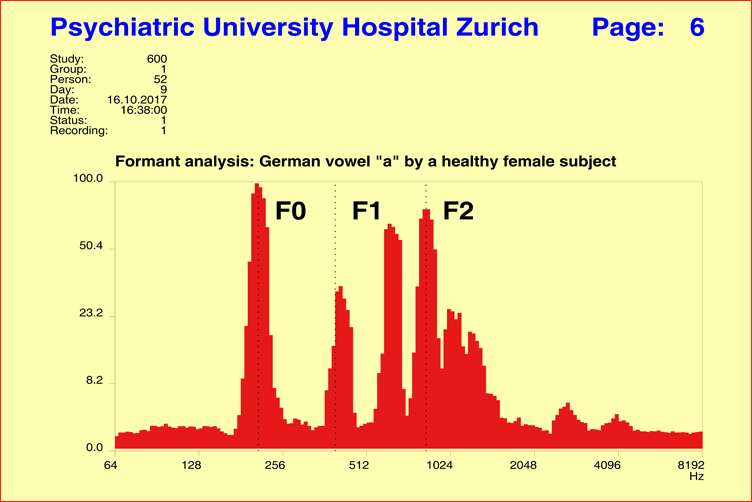 Overtone Distribution in a Female Speaker