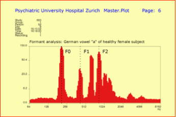 Overtone Distribution of a Female Speaker